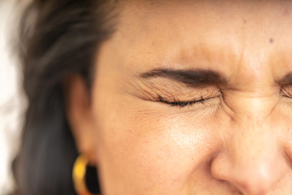 Primo piano di una donna con gli occhi chiusi e sopracciglia aggrottate, segni di stanchezza visibile sul contorno occhi. Focus sullo sguardo affaticato e sull’invecchiamento palpebrale. By Centro Medico Chirurgico Matteotti.
