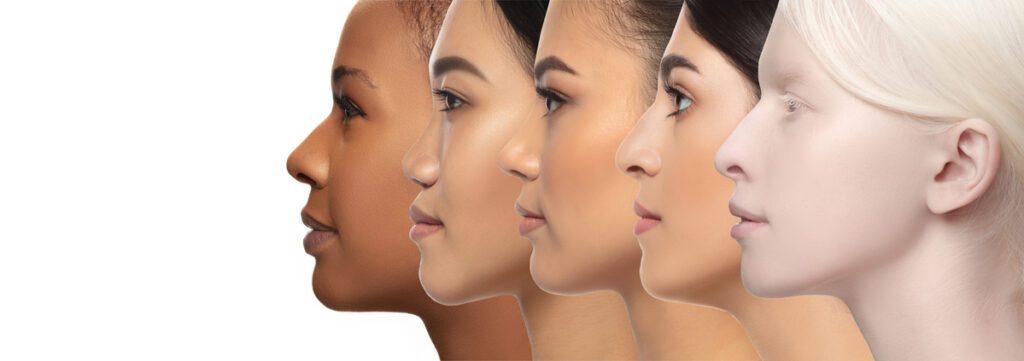Profili laterali di donne con tratti e carnagioni diverse, in fila ordinata. Bellezza naturale, armonia dei volti e approccio minimal alla rinoplastica. By Centro Medico Chirurgico Matteotti.